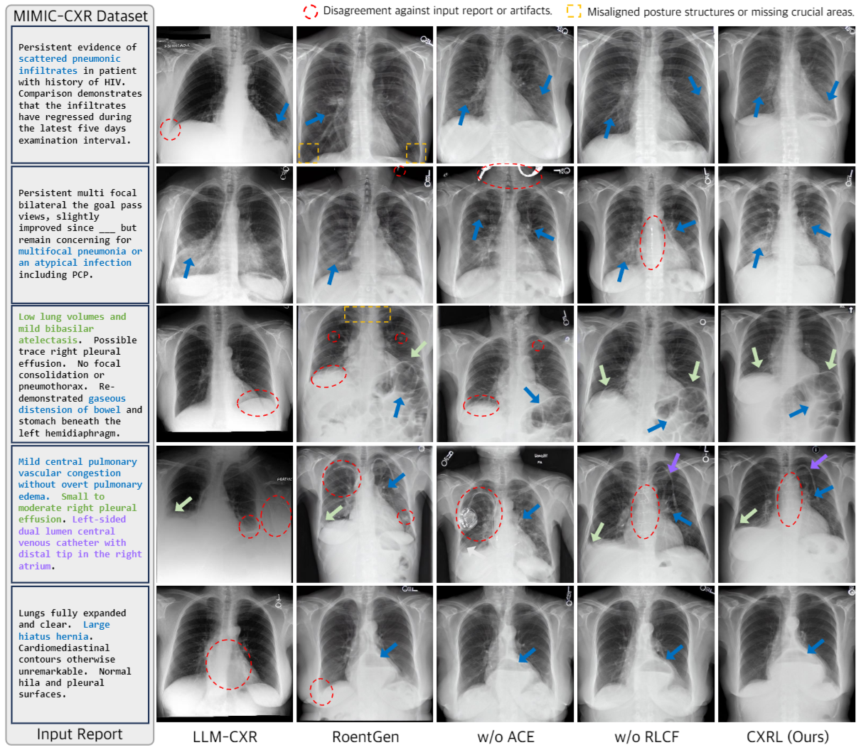 Qualitative ablation